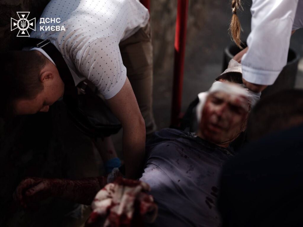 Рятувальники працюють на місцях прильотів у Києві (фото) 1 450386845 895063749328182 2356100528691358441 n - Вікно Відновлення