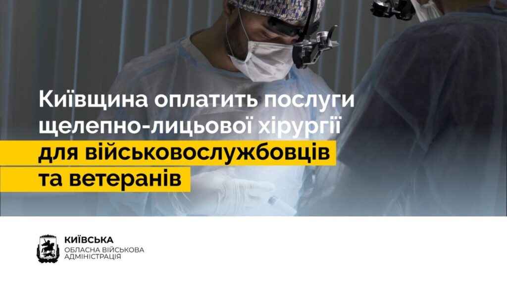 Київська область ініціювала новий вид допомоги воїнам: деталі